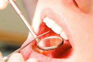 黄连能治口腔溃疡吗 黄连治疗口腔溃疡偏方