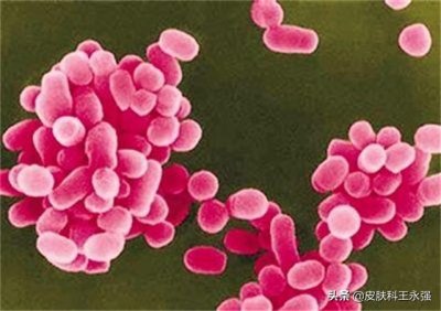 ​布病是什么病（布病是怎么传染的）